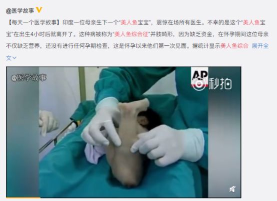 孕妈叶酸不足，真的不负责任吗？