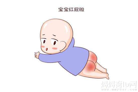 贝亲婴儿护臀霜怎么样 宝妈告诉你效果