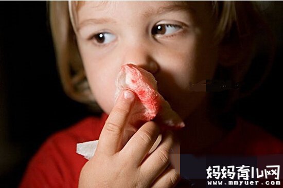小孩总是流鼻血怎么办 推荐适合孩子流鼻血吃的食物