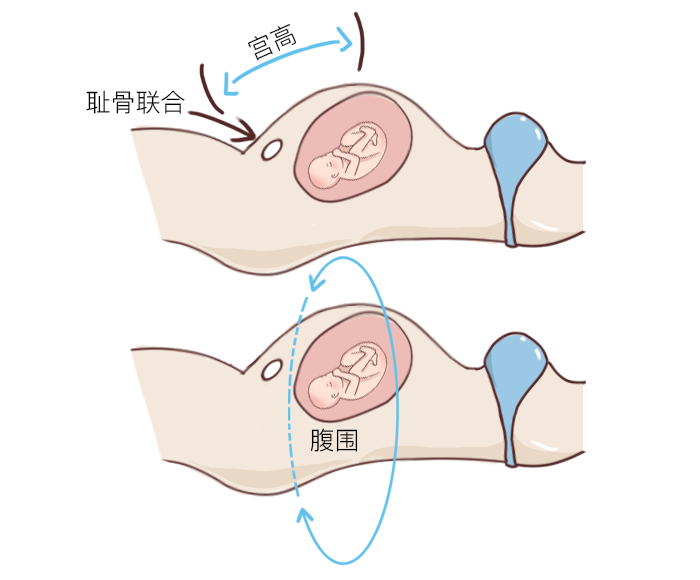宫高、腹围能反映胎宝宝的发育情况，千万别忽视了