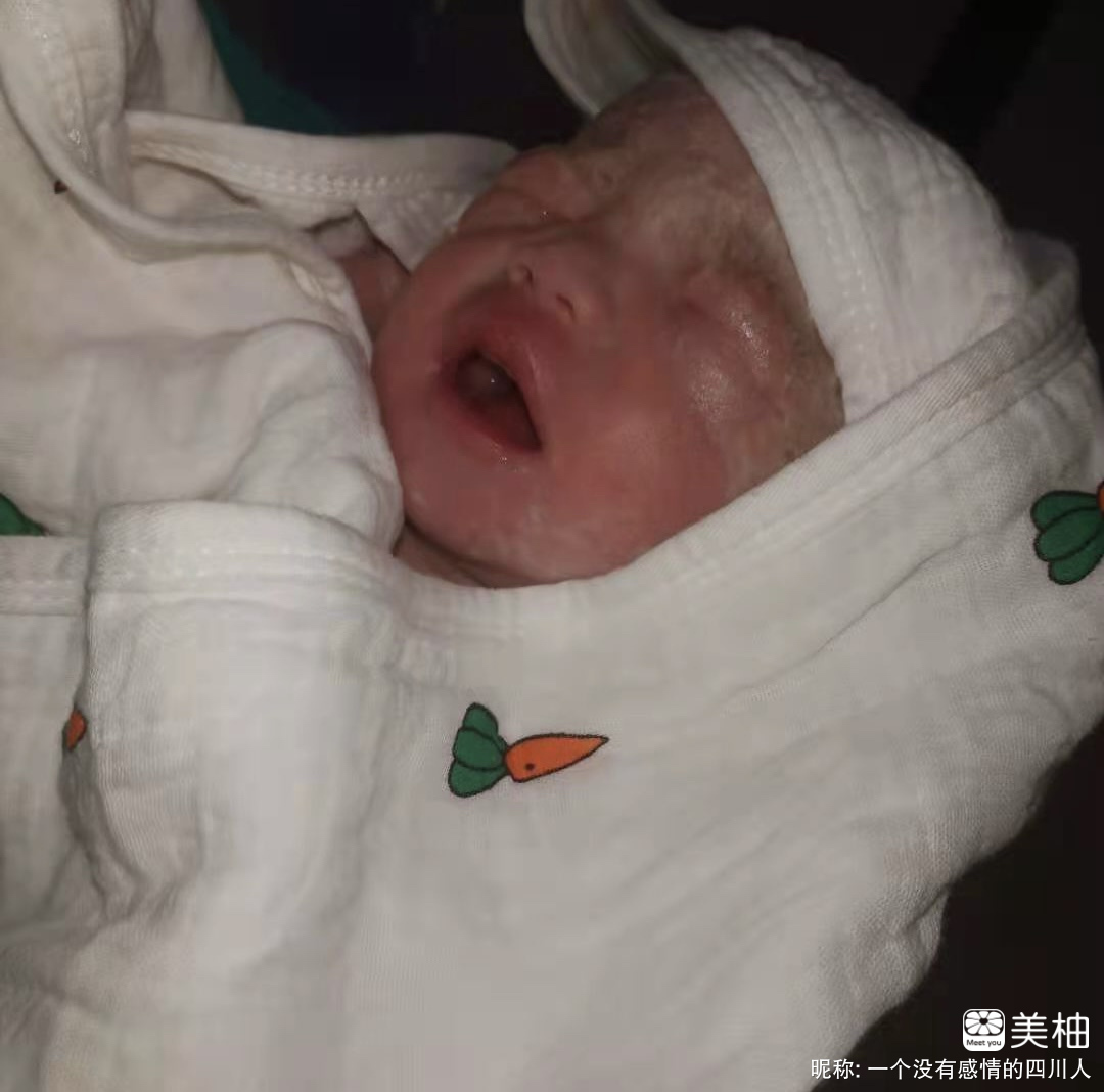 宫外孕后再次怀孕生下了宝宝