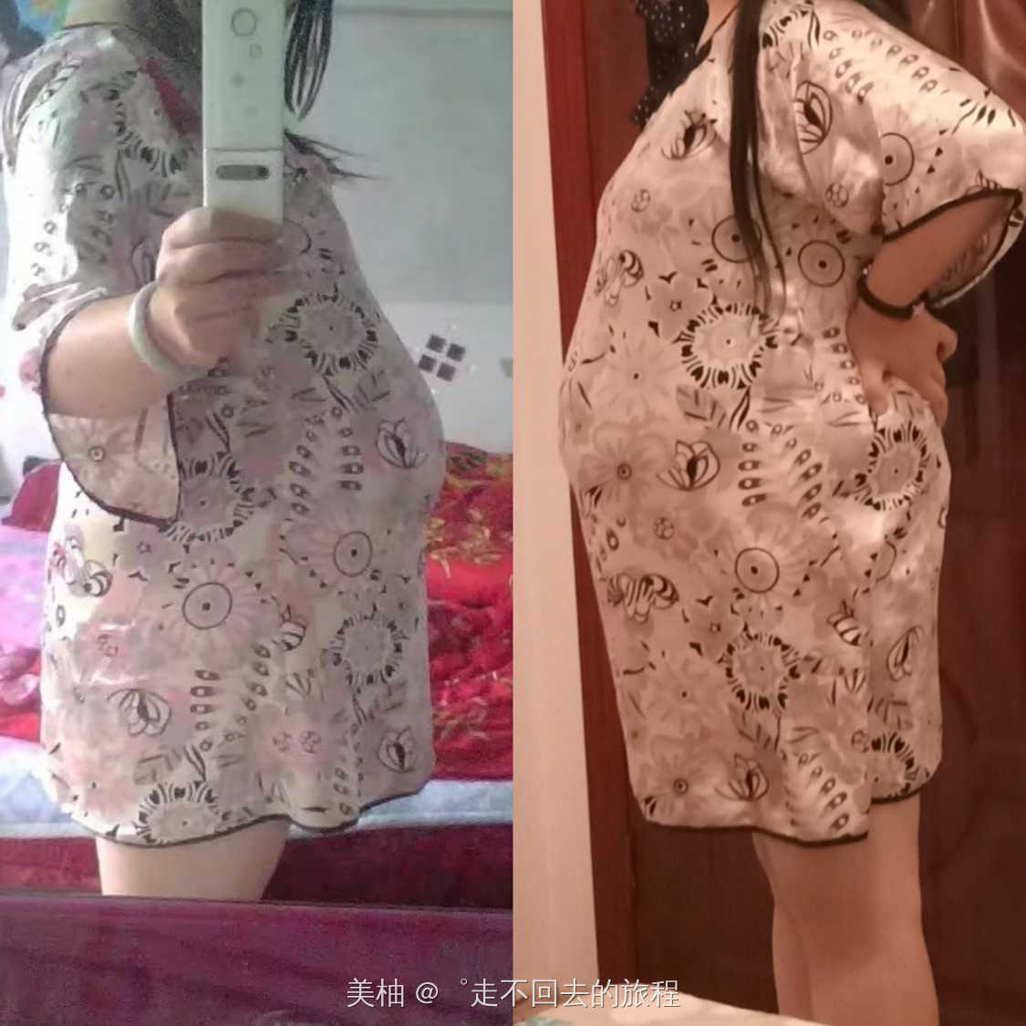 孕期妊娠糖尿病，血糖那么高也坚持过来了！！！