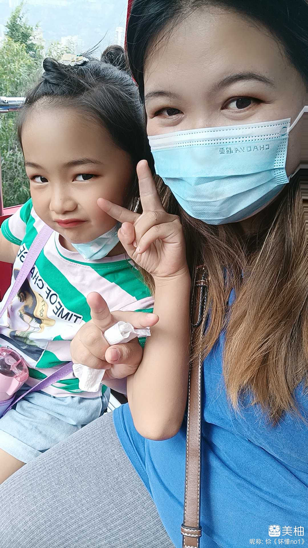 孕期低血糖