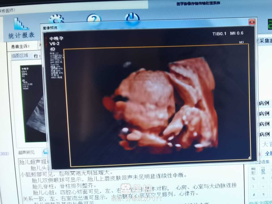 头胎大龄孕妇怀孕以后，真的是步步惊心
