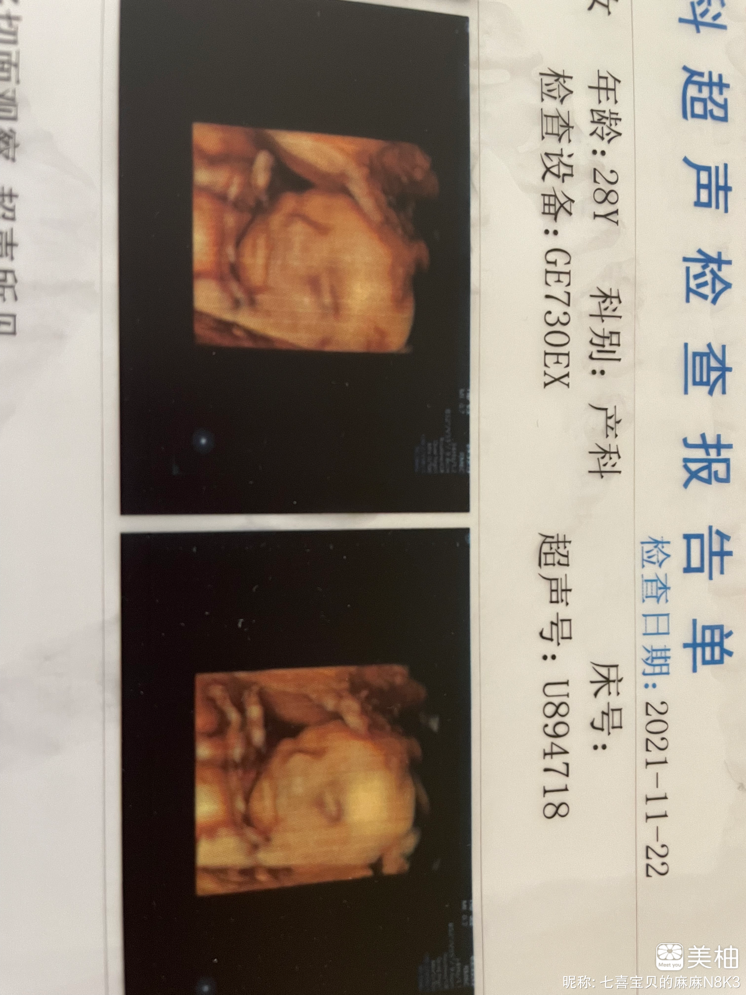 顺产男宝一枚，说说孕期那些事