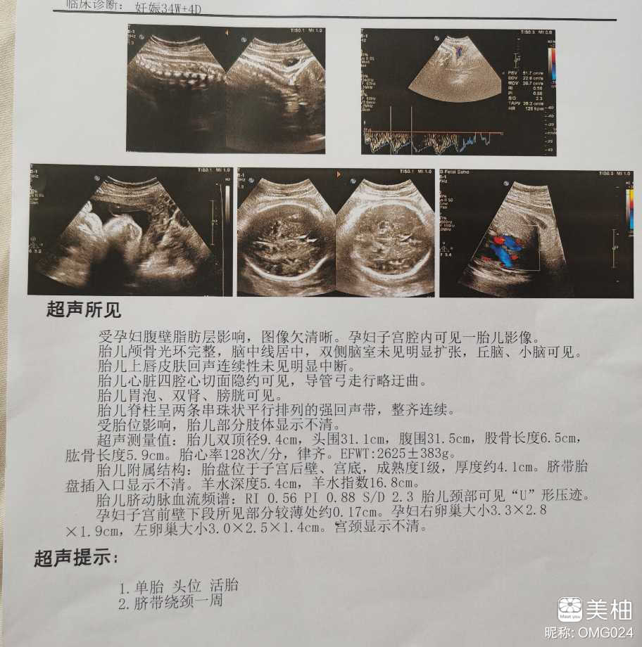 回顾整个二胎无症状孕期，分享给姐妹们～也是自己今后的回忆～～
