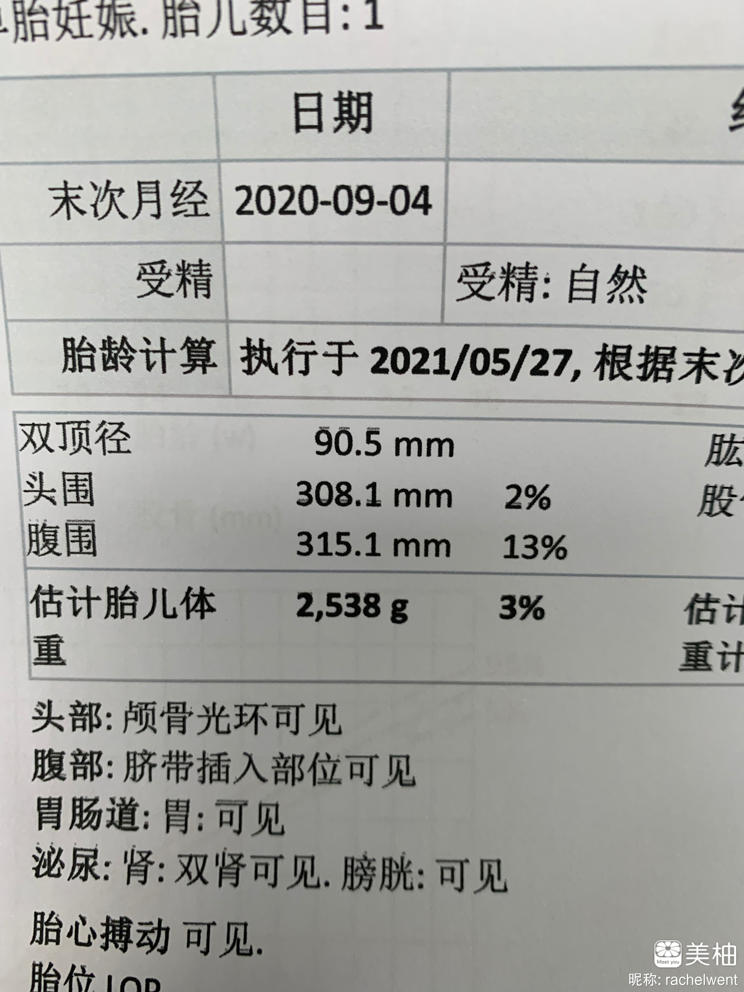 安慰你的孕期玻璃心（下）