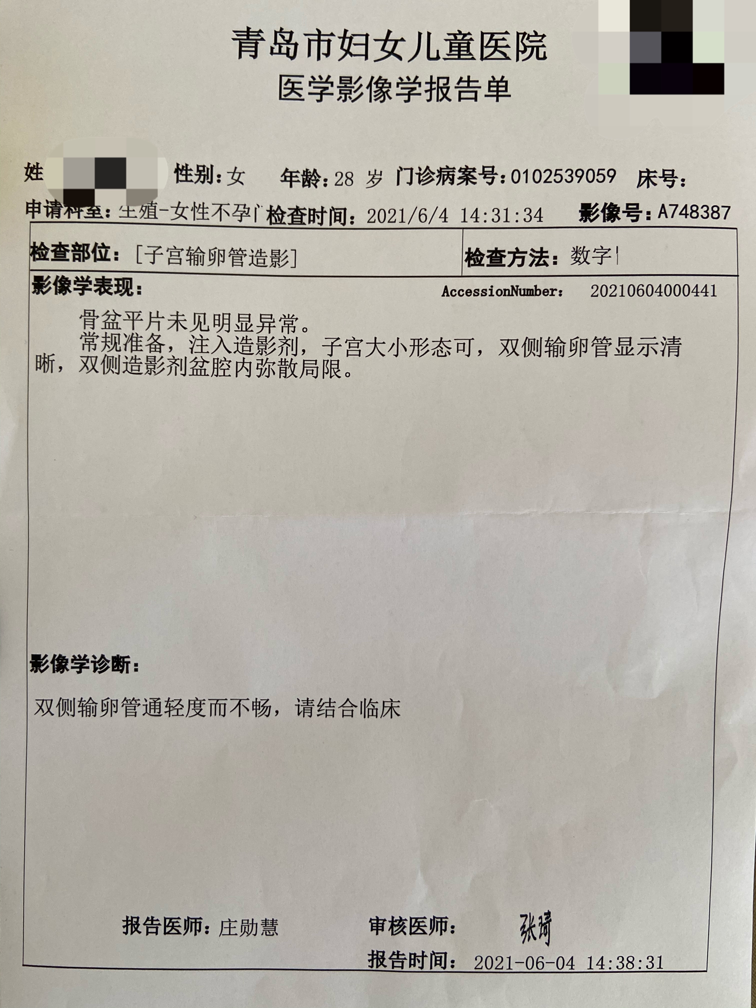 输卵管造影真的不可怕！（个人感受）