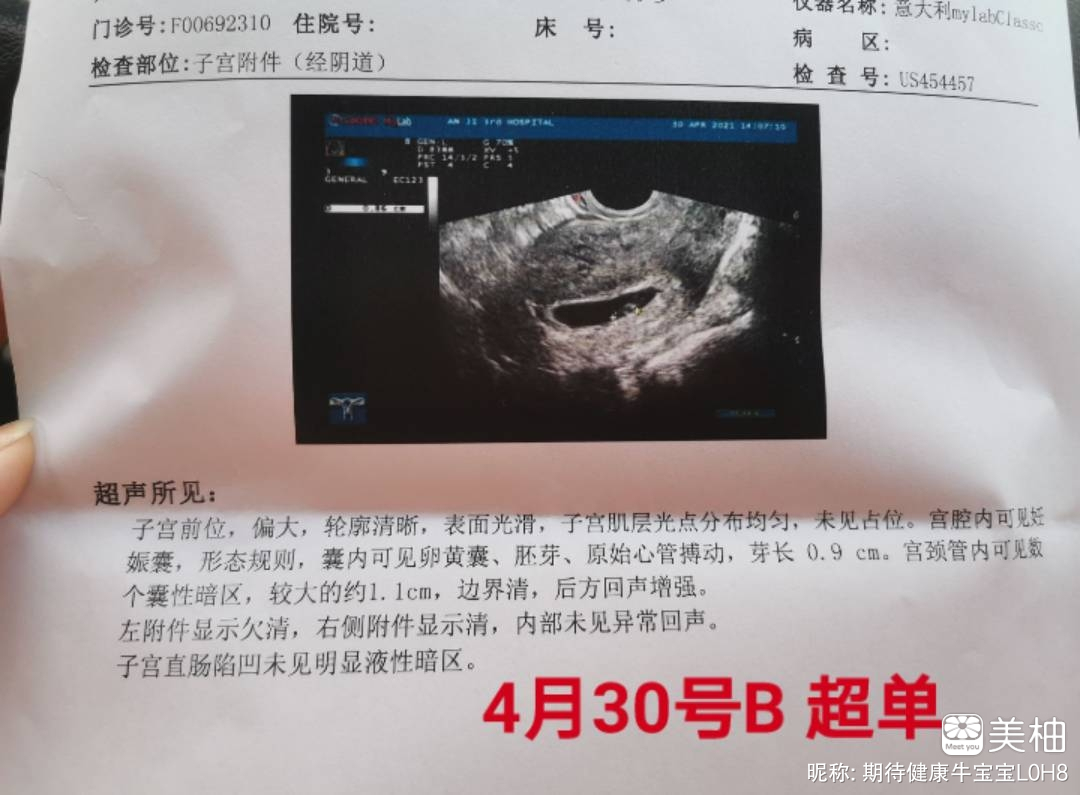 3月25号排卵，目前12周，有同期的孕妈可以一起来交流
