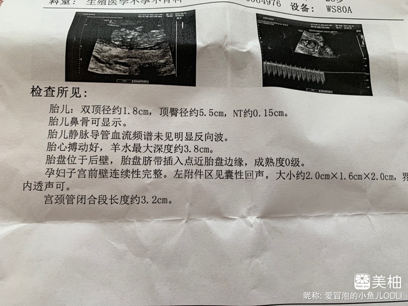 生殖科毕业了！！