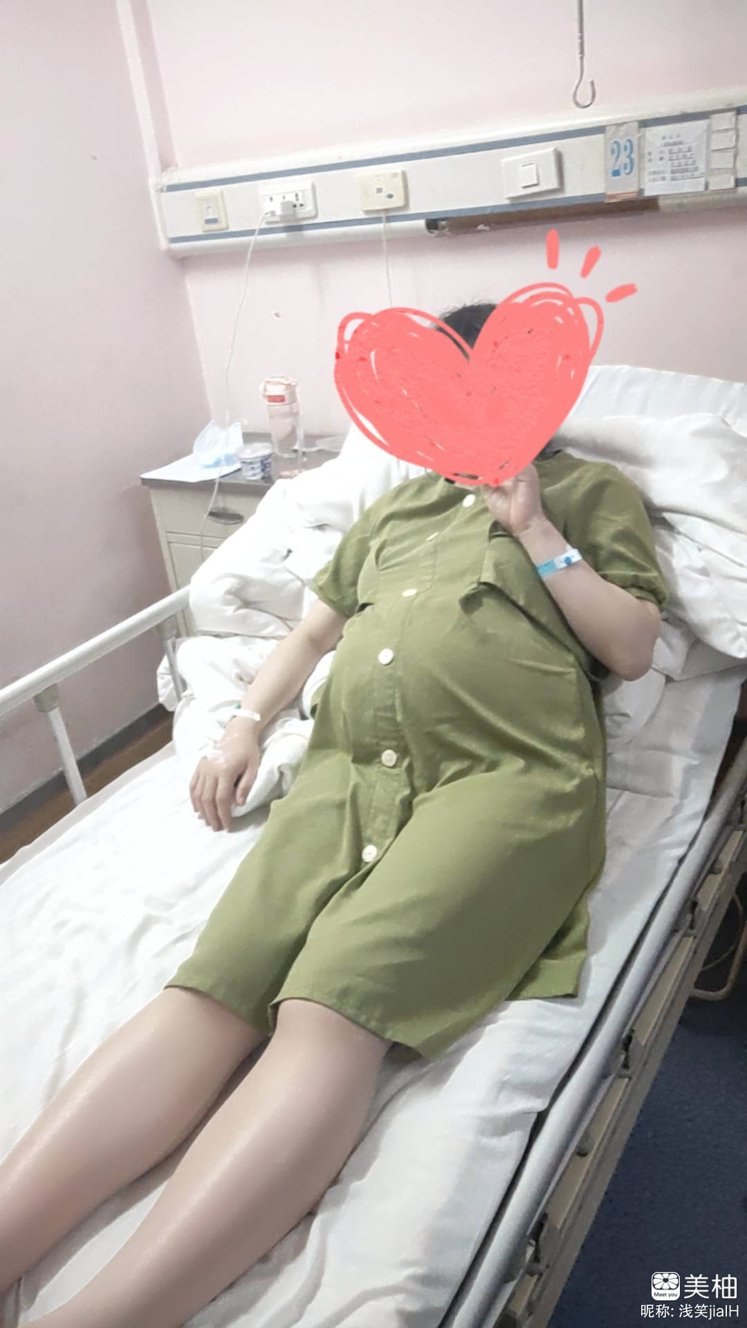 40+1催产顺产男宝  新生儿科住院一周