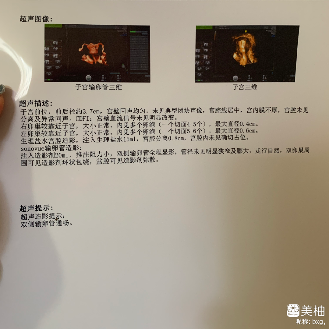 今天终于鼓足勇气做了输卵管超声造影