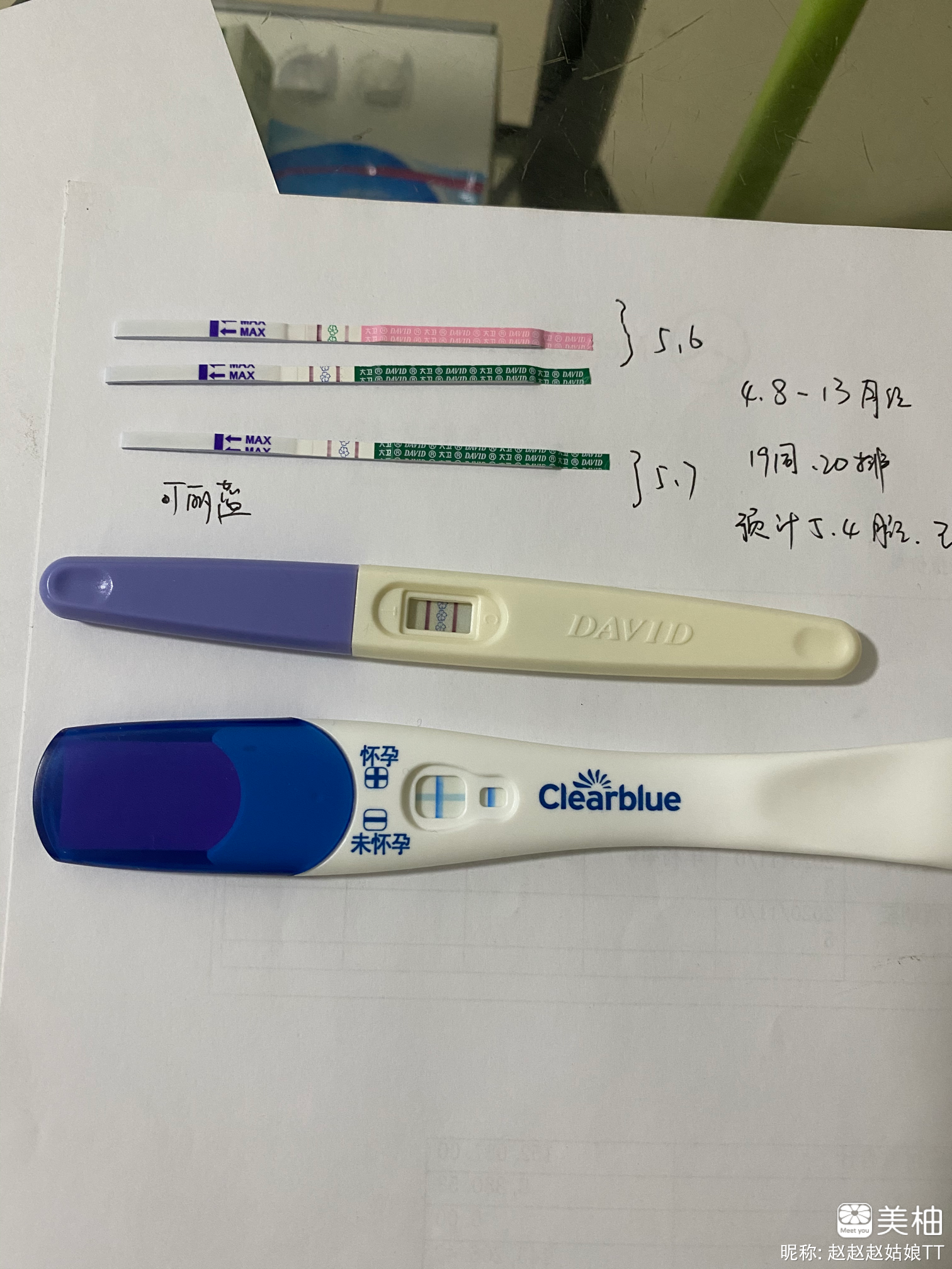 宫腹腔镜切除右侧输卵管术后次月怀孕1