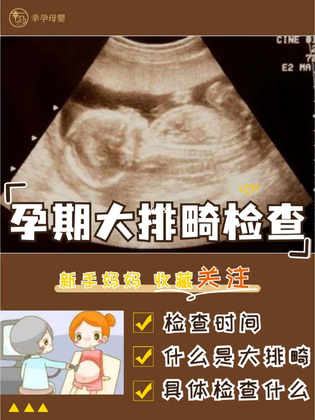 准备怀孕前需要检查哪些优生优育的项目呢？