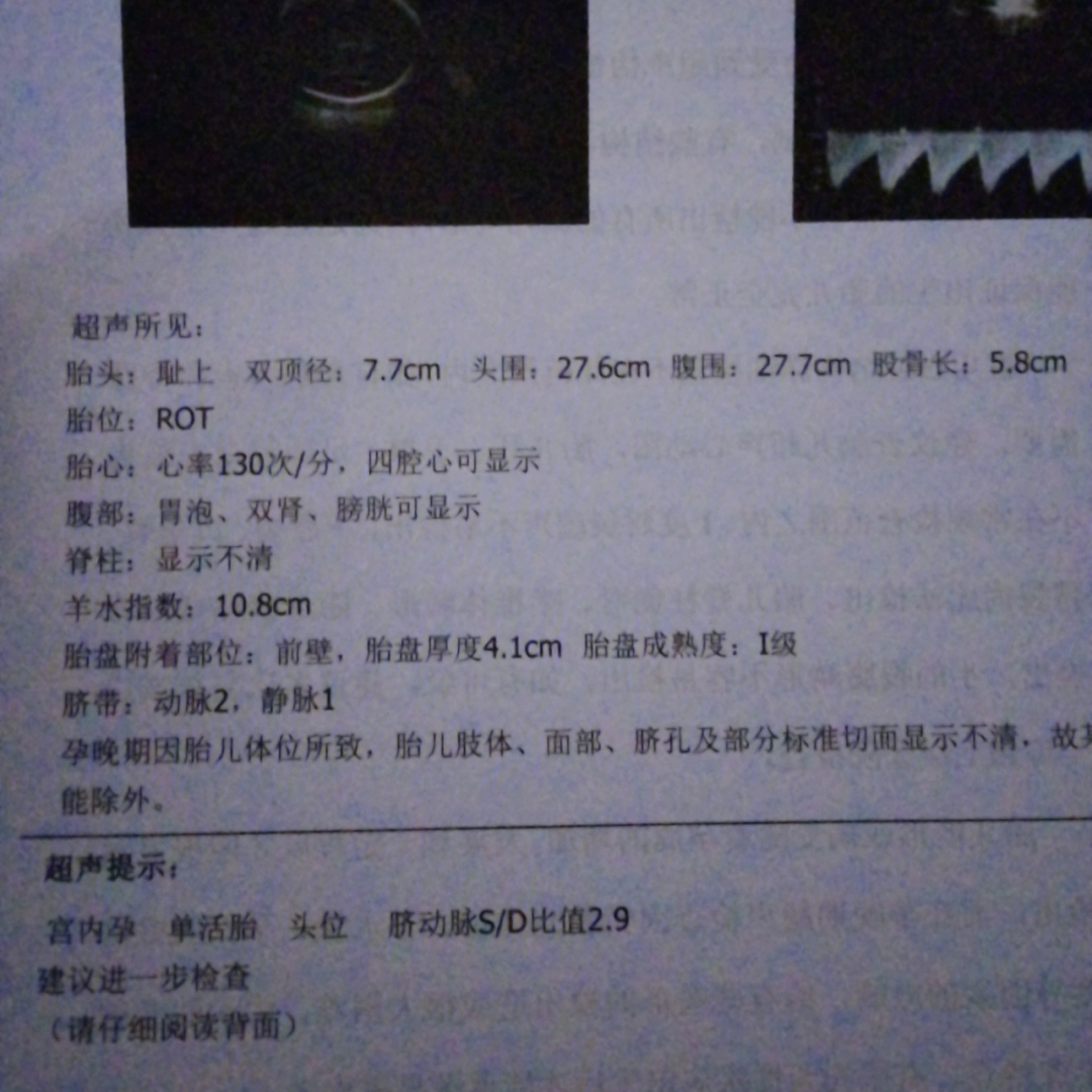 大肚延产多胎孕中孕文_孕产检查时间表图片_初孕检查报告单图片