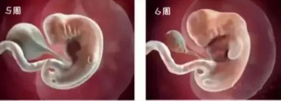 彩超检查胎儿比实际孕周大_彩超检查比实际孕周大_孕产彩超检查时间表