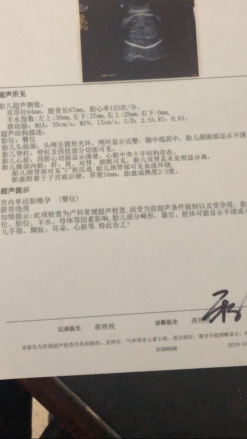 孕中孕延产小说_青楼虐孕延产塞延产棒_准妈妈孕产检查