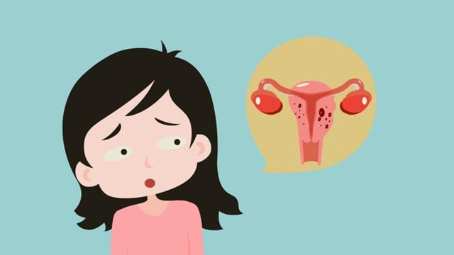 有子宫肌瘤，还能正常备孕怀孕吗？