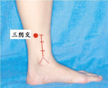 三阴交穴位在哪？三阴交穴位的作用